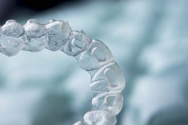 Orthodontics:   Ways To Tell If Clear Aligners Are Right For You